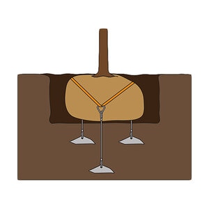 Anchor Kit w/ Cable Clamps